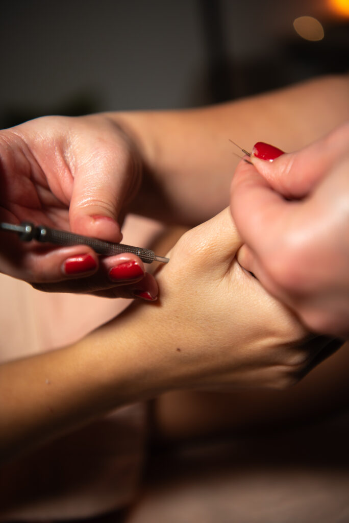 Su-jok terapija u salonu Wellness Concept na Novom Beogradu